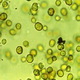   Microplankton
